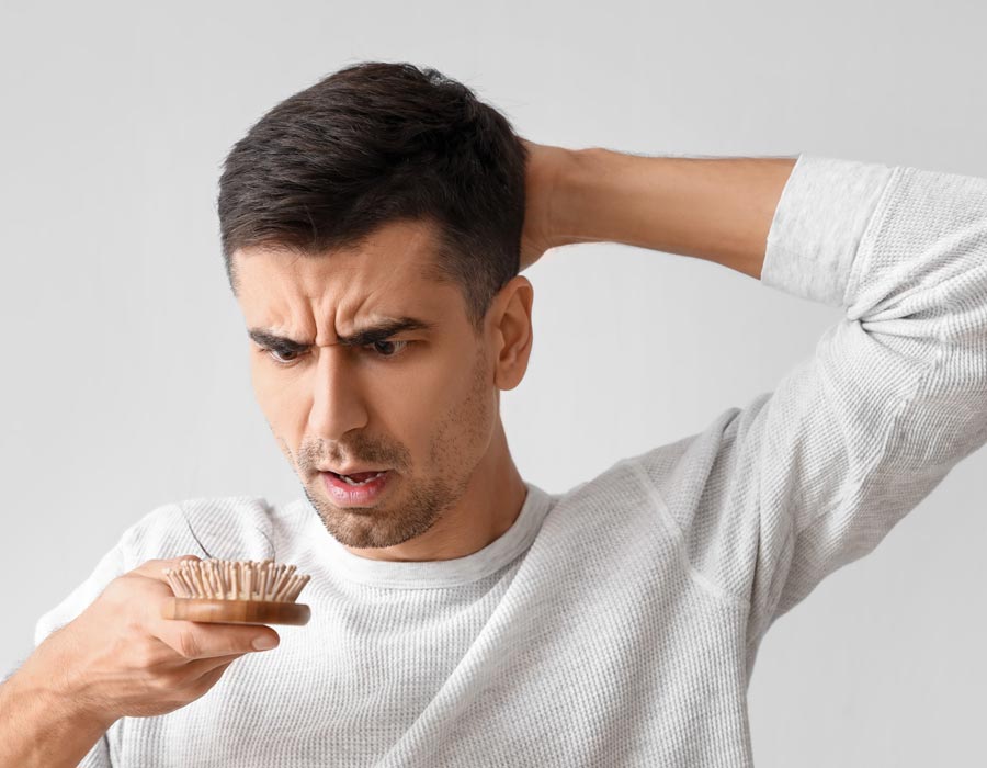caduta capelli uomo