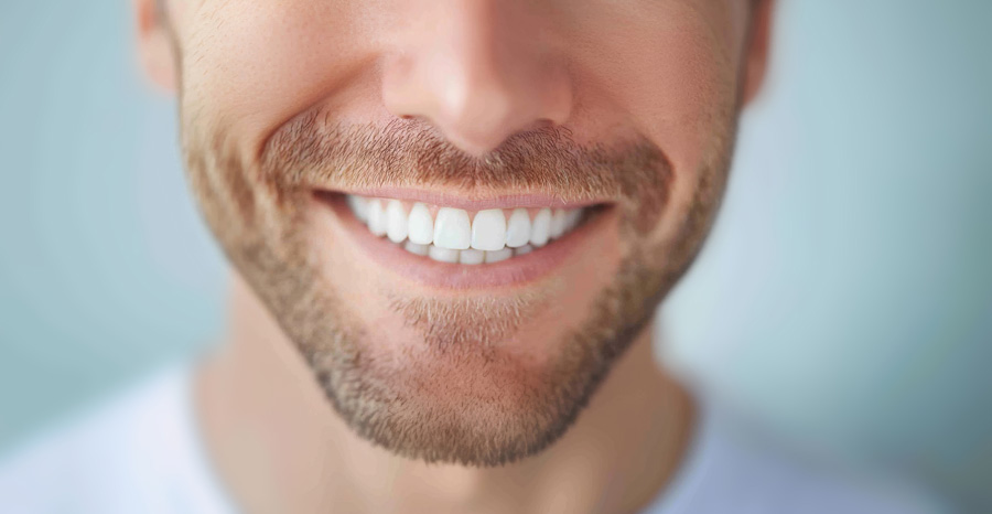 denti bianchi e luminosi